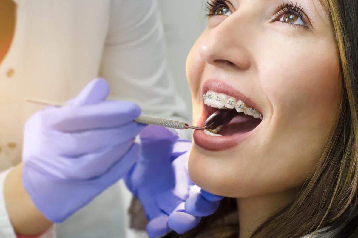 Orthodontie adulte à Casablanca