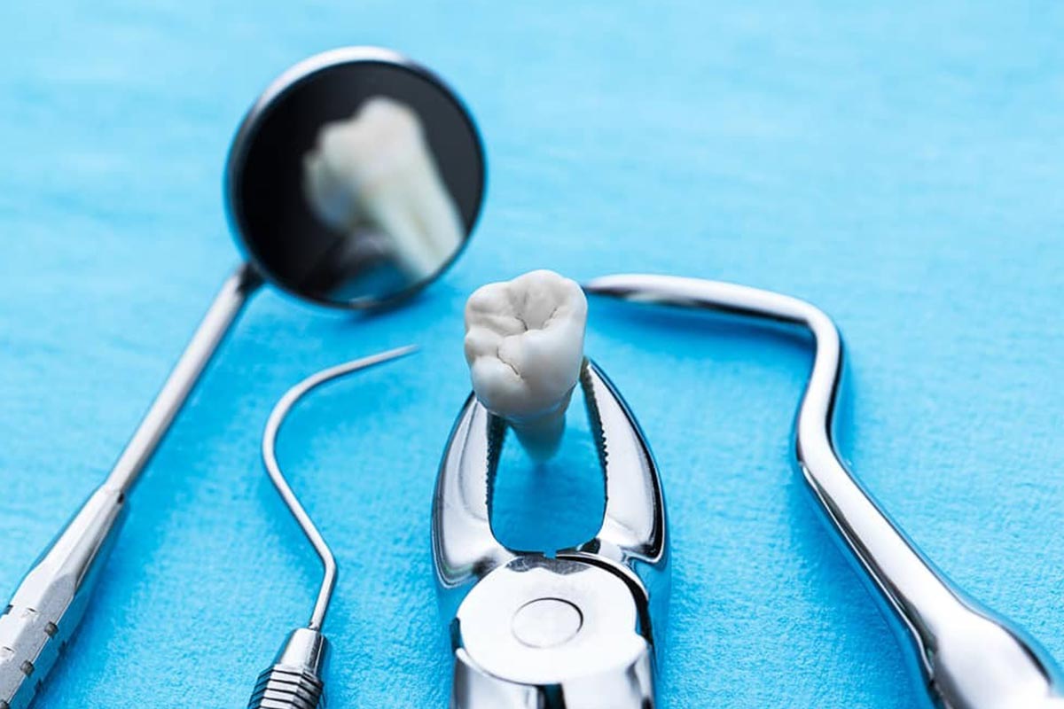 Extraction dentaire à Casablanca : ce qui est normal et ce qui doit vous alerter